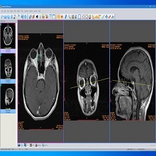 Sante DICOM Viewer Pro 14.3 Download