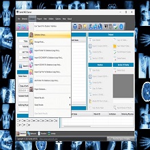 Sante PACS Server 4.4.3 Download